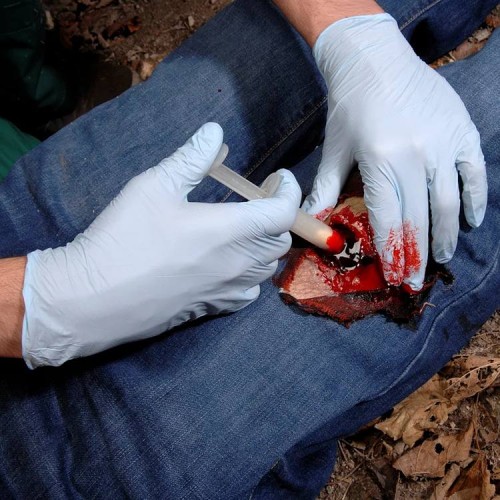 Аппликатор гемостатический с гранулами Rhino Rescue в Балаково хитозановый